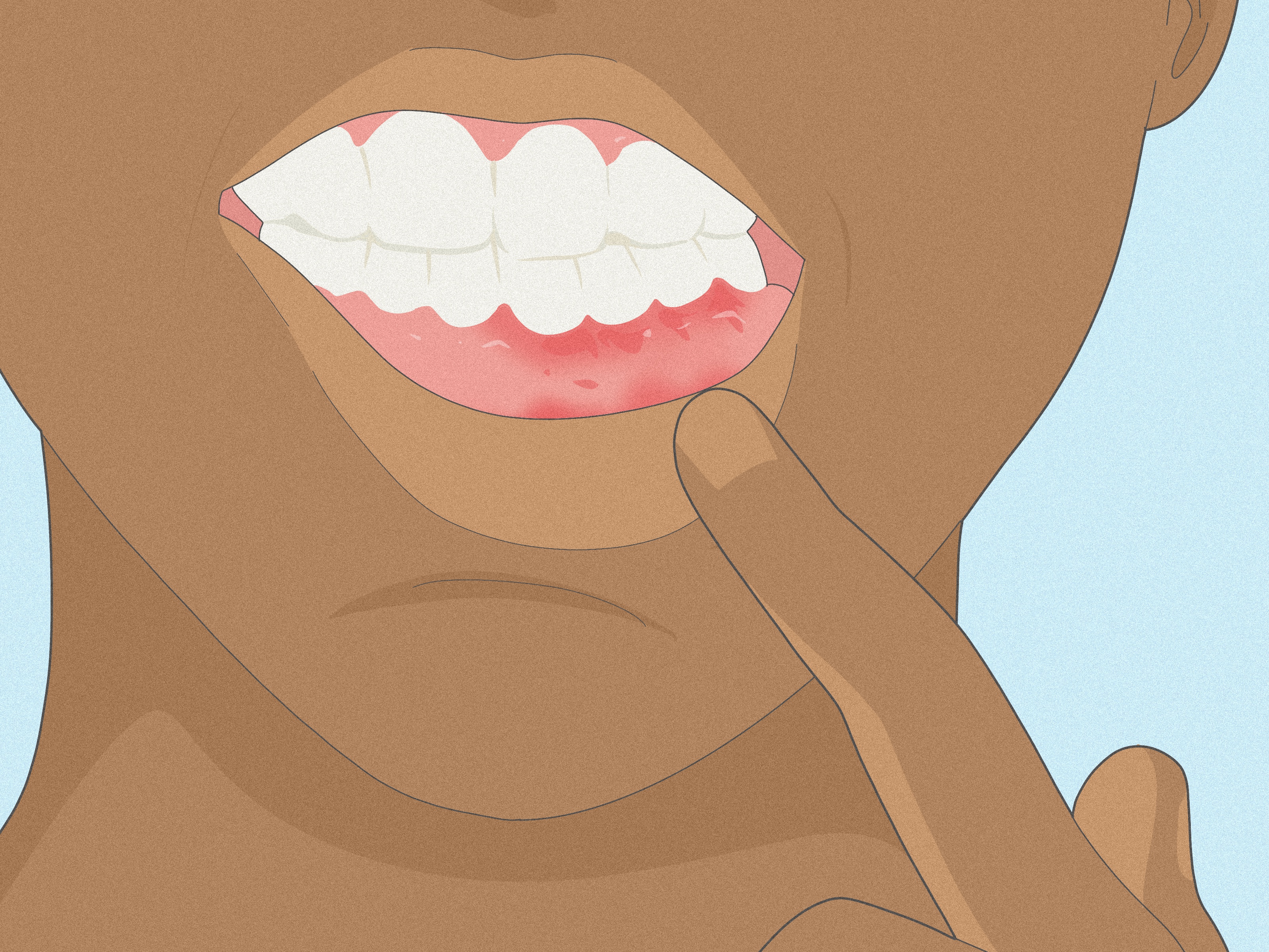 Why You Should Be Honest With Your Dentist About Vaping